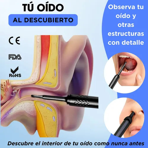 Limpiador de oídos de alta definición