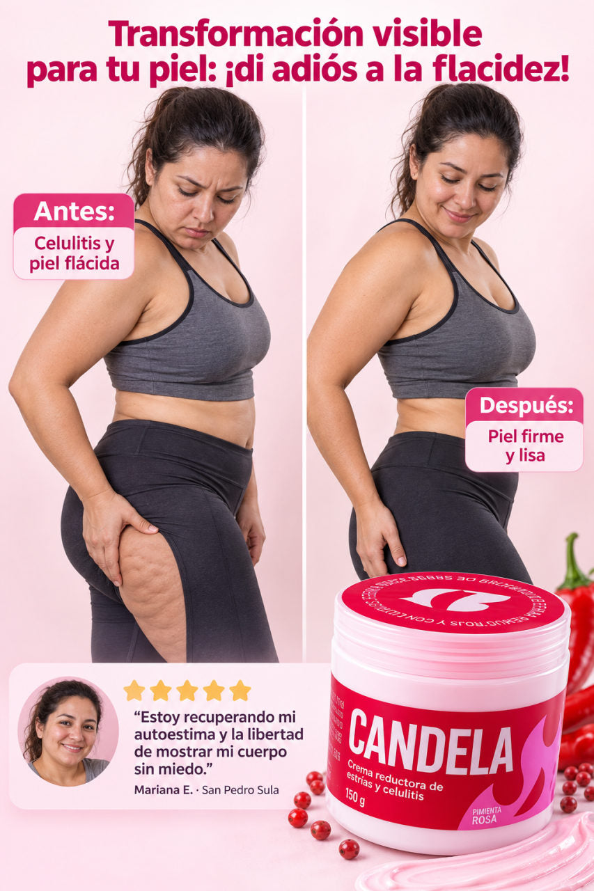 Candela - Crema reductora — T · LA TRANSFORMACIÓN